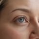 blefaroplastyka